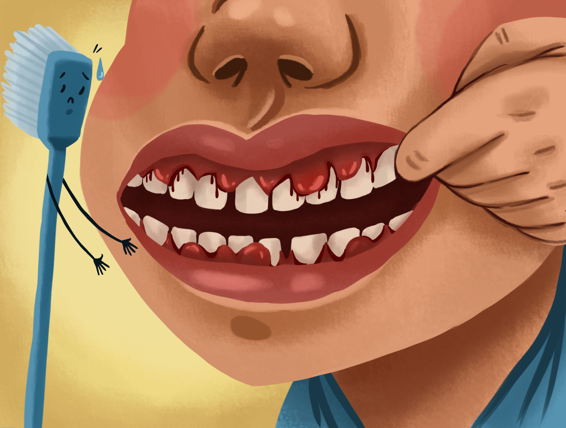 gum health, gingivitis, oral hygiene, dental cleaning, bleeding gums, gingivitis, periodontal disease